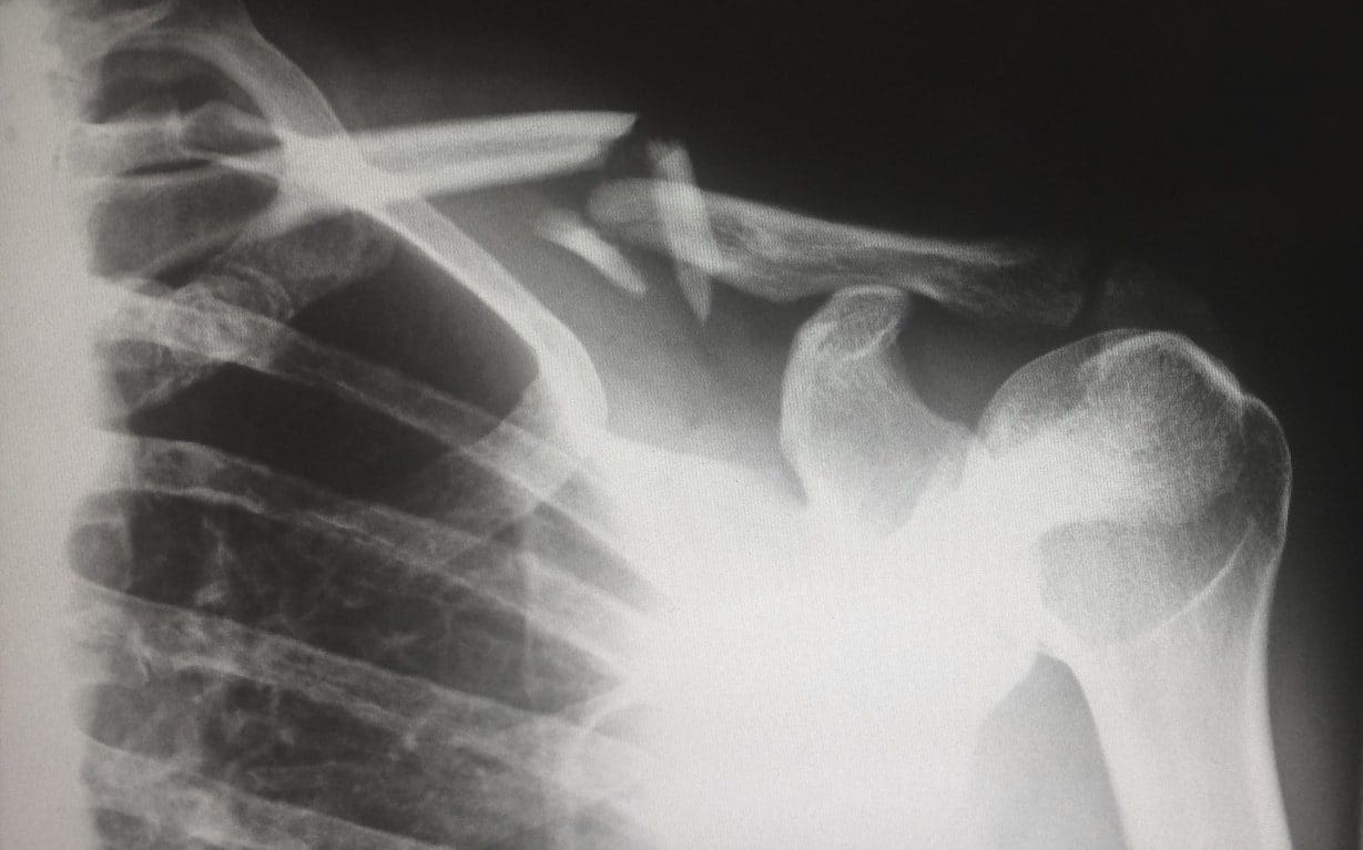New recommendations released about Pediatric CT Examinations
